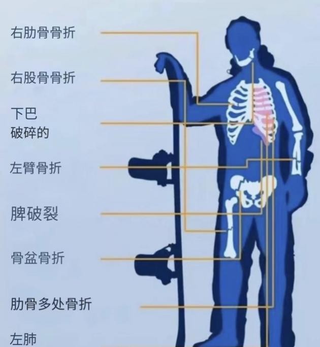 尊龙娱乐用现金博一下奥地利RedBull激发无限可能让梦想在冰雪世界肆意绽放